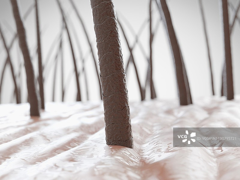 不健康的头发插画图片素材