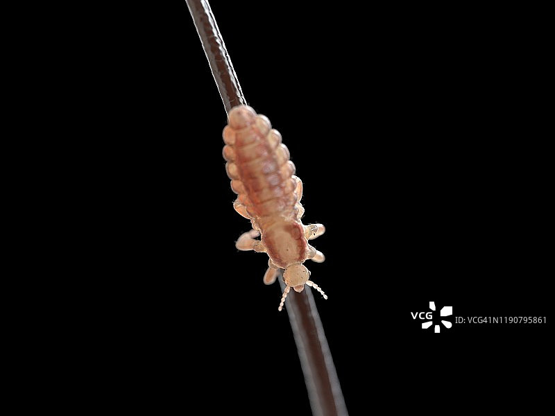 头虱插画图片素材