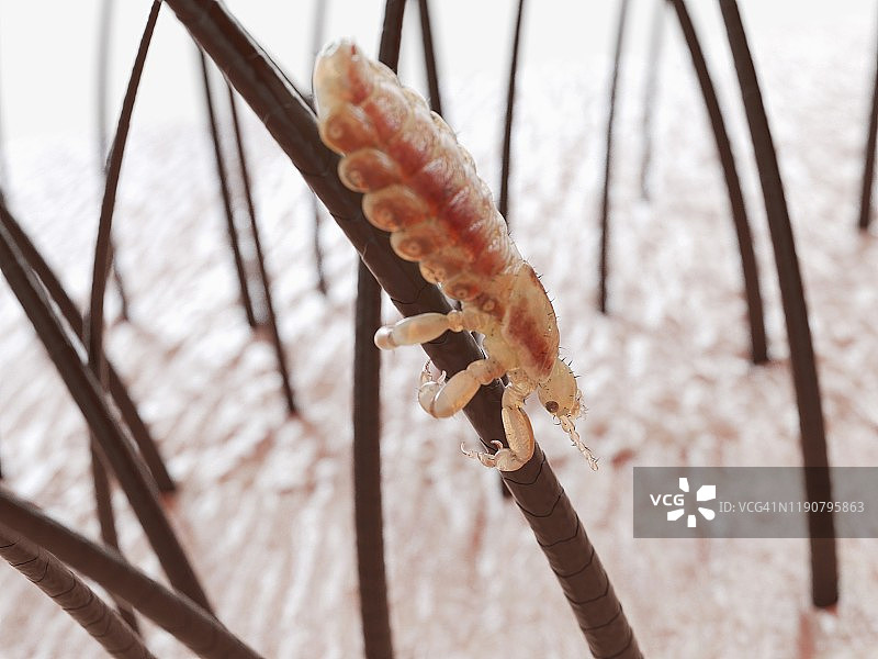 头虱插画图片素材