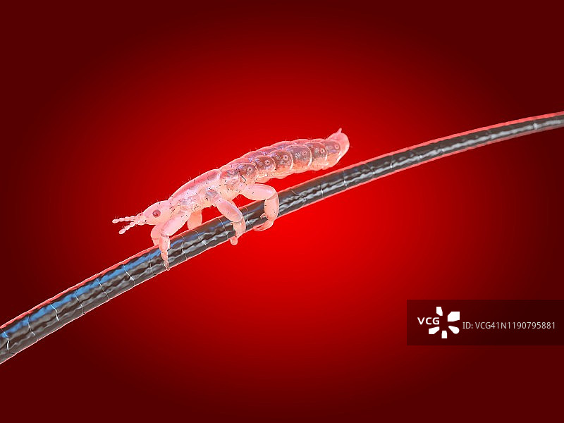 头虱插画图片素材