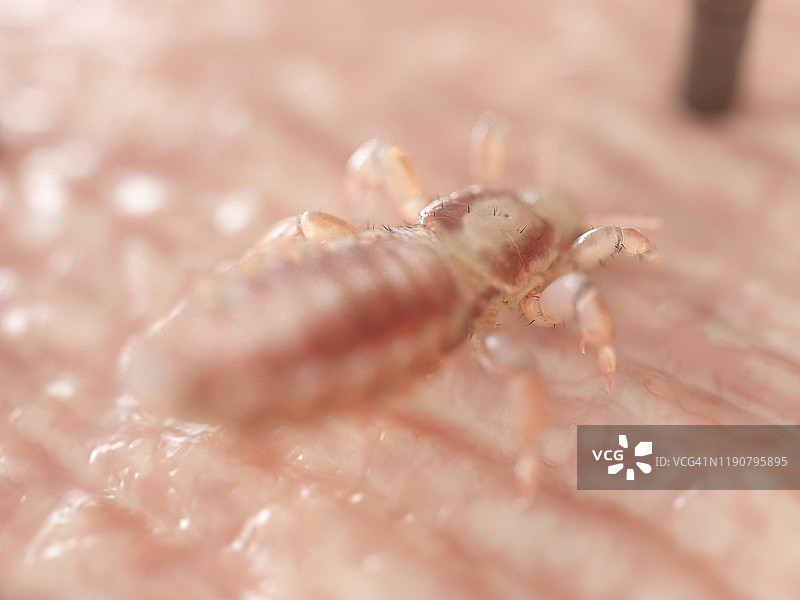 头虱插画图片素材