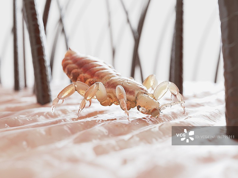 头虱插画图片素材