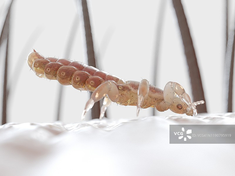 头虱插画图片素材