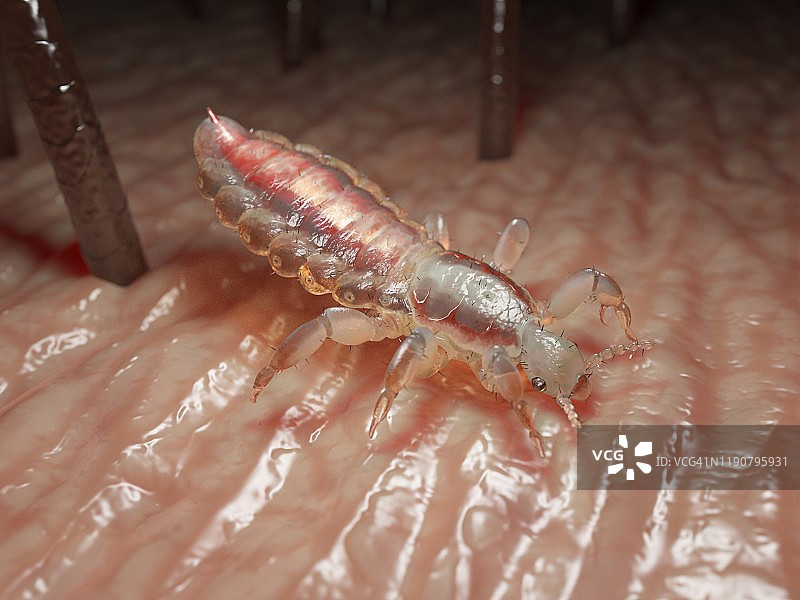 头虱插画图片素材