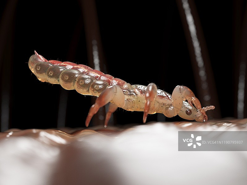 头虱插画图片素材