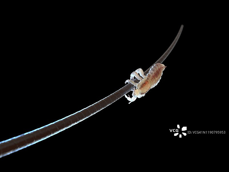 头虱插画图片素材