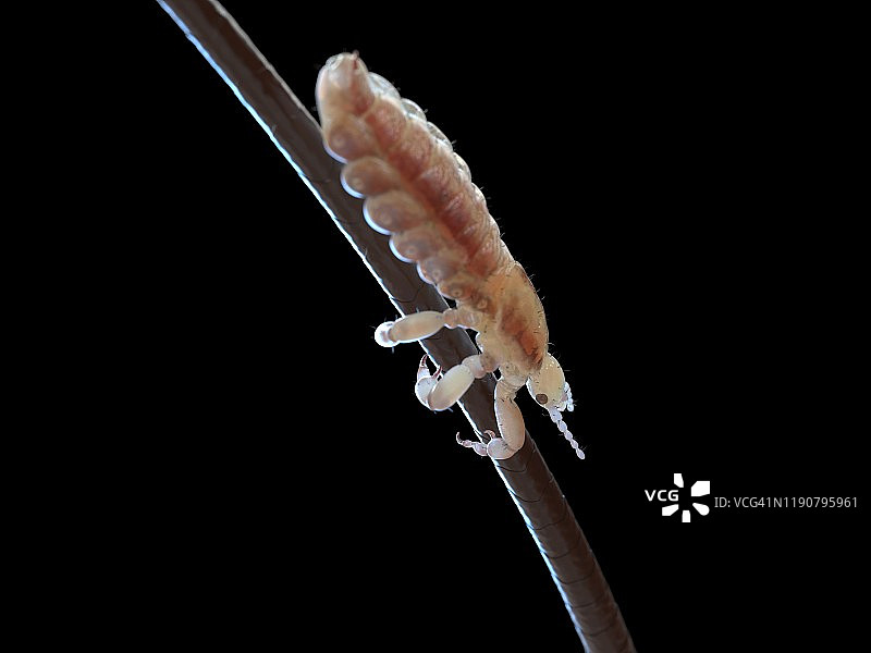 头虱插画图片素材