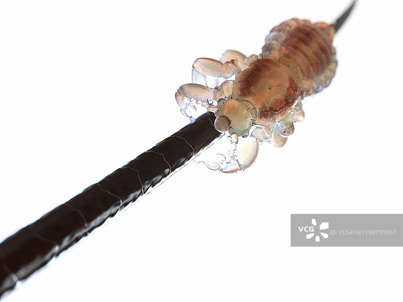 头虱插画图片素材