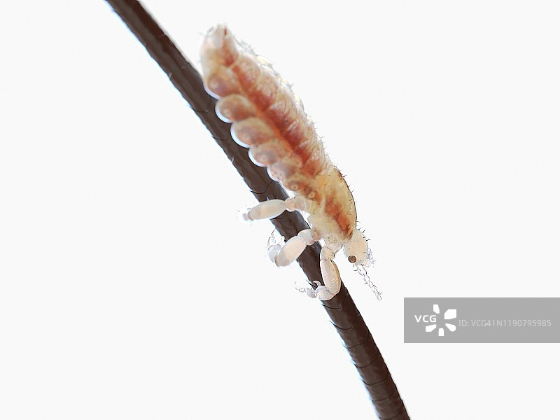 头虱插画图片素材