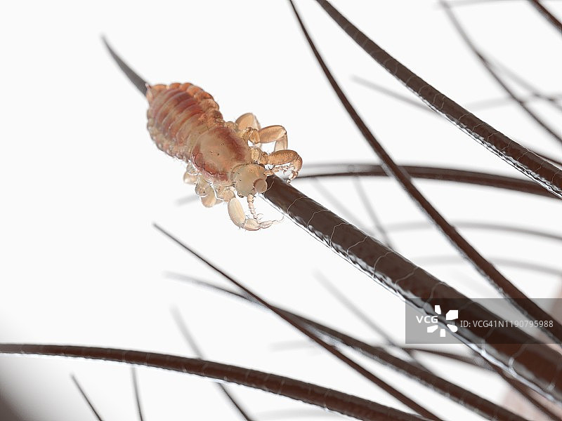 头虱插画图片素材