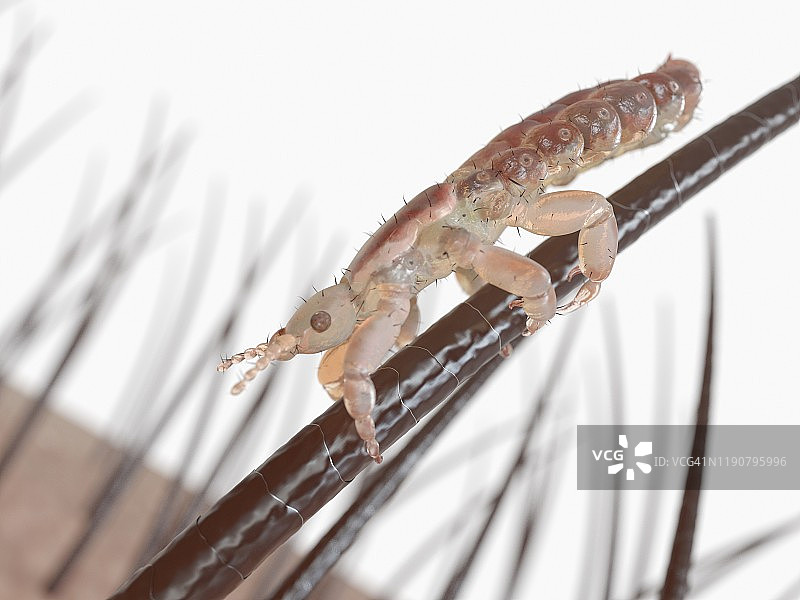 头虱插画图片素材