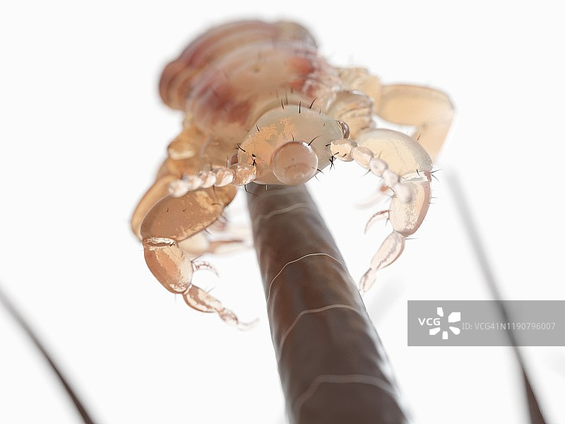 头虱插画图片素材