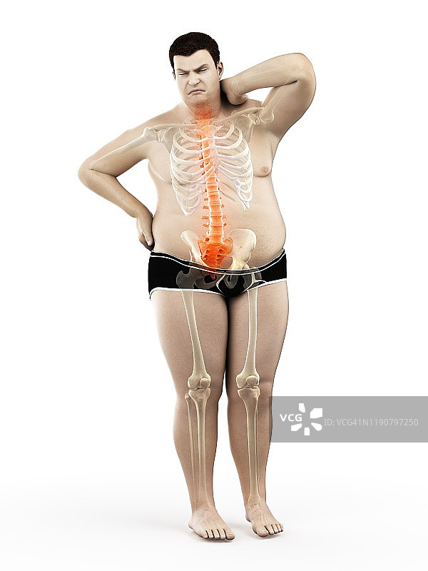 背痛的肥胖男人插画图片素材