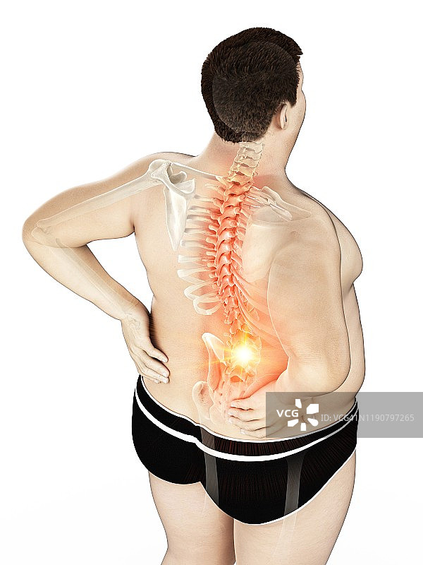 背痛的肥胖男人插画图片素材