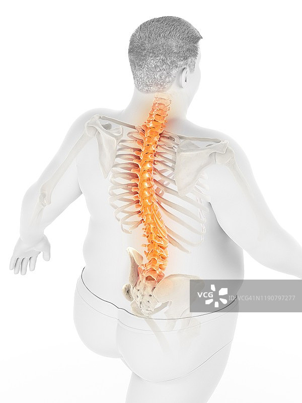 背痛的肥胖男人插画图片素材