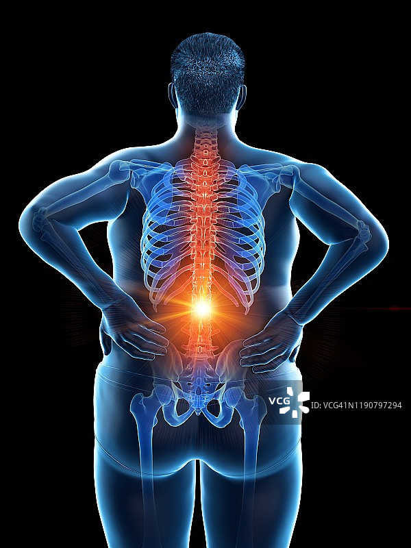 背痛的肥胖男人插画图片素材