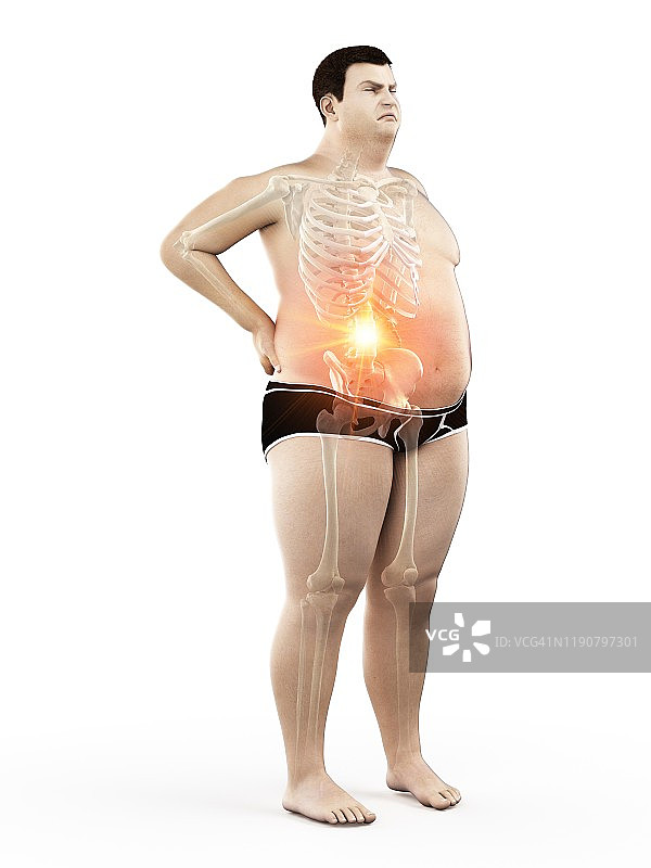 背痛的肥胖男人插画图片素材