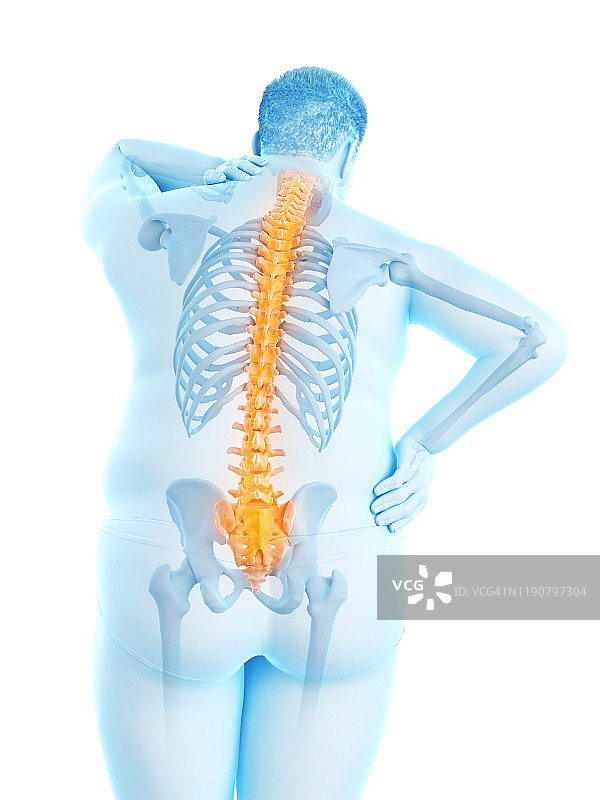 背痛的肥胖男人插画图片素材