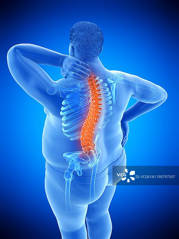 背痛的肥胖男人插画图片素材