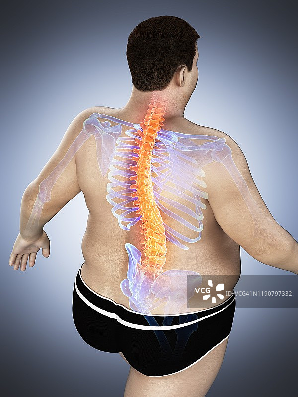 背痛的肥胖男人插画图片素材