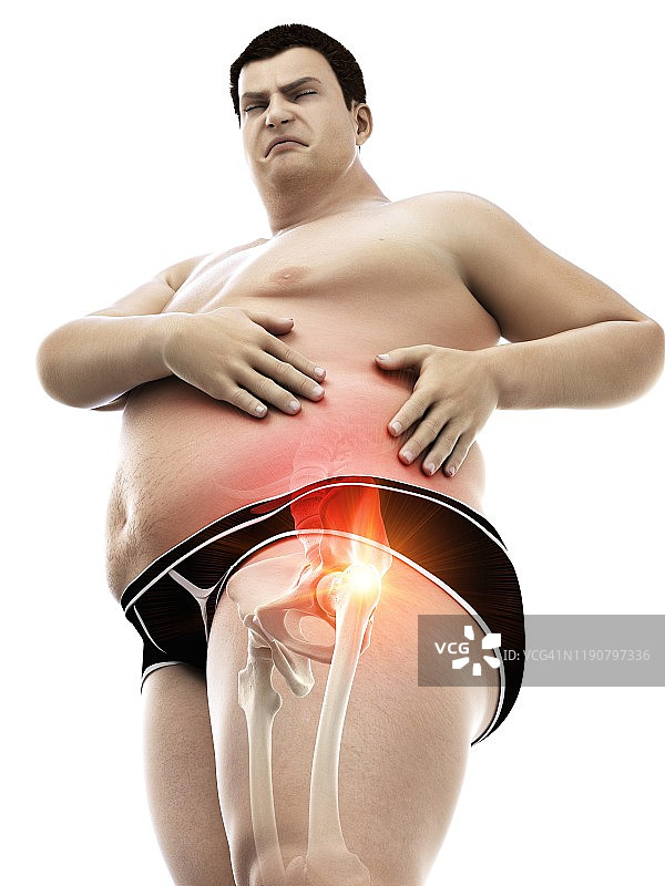 患有髋部疼痛的肥胖男子插画图片素材