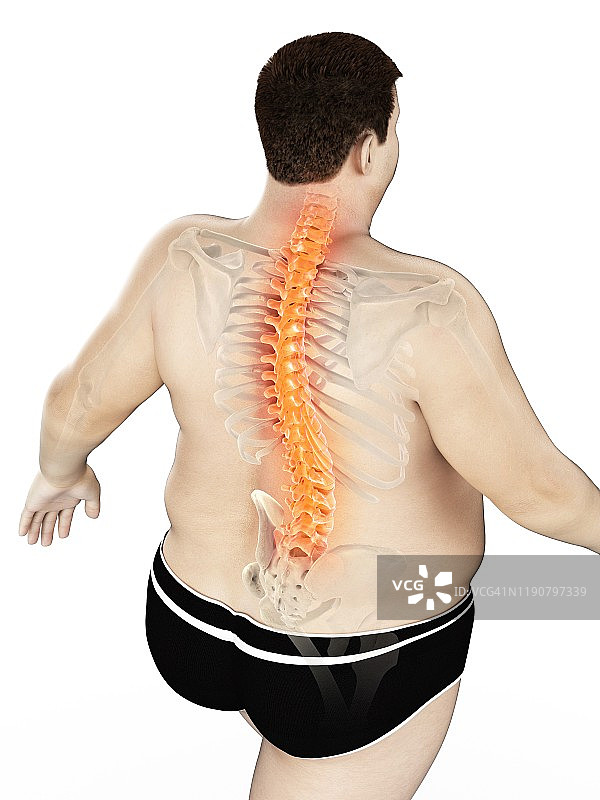 背痛的肥胖男人插画图片素材