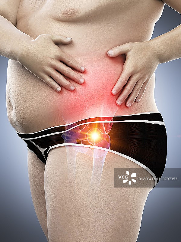 患有髋部疼痛的肥胖男子插画图片素材