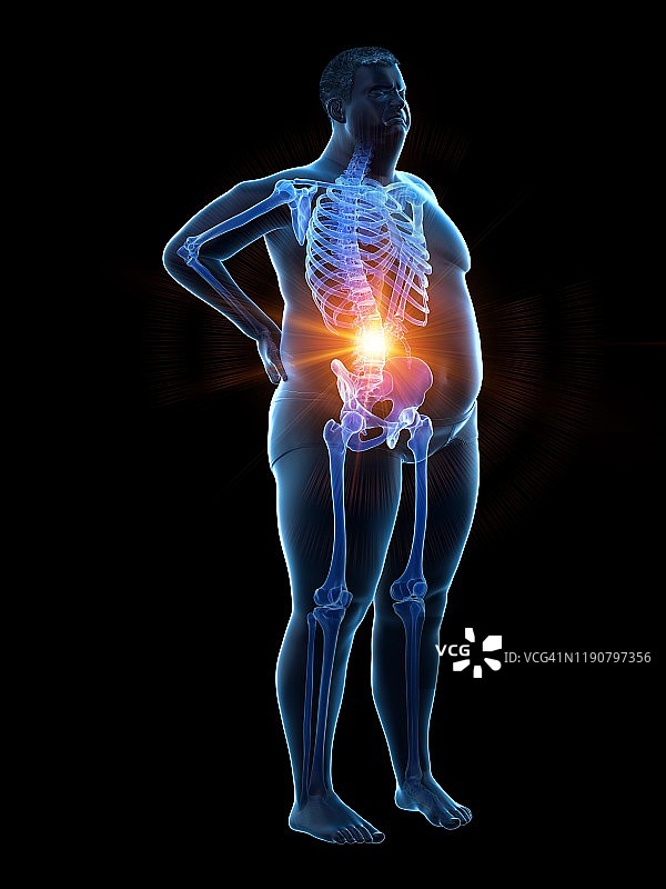 背痛的肥胖男人插画图片素材