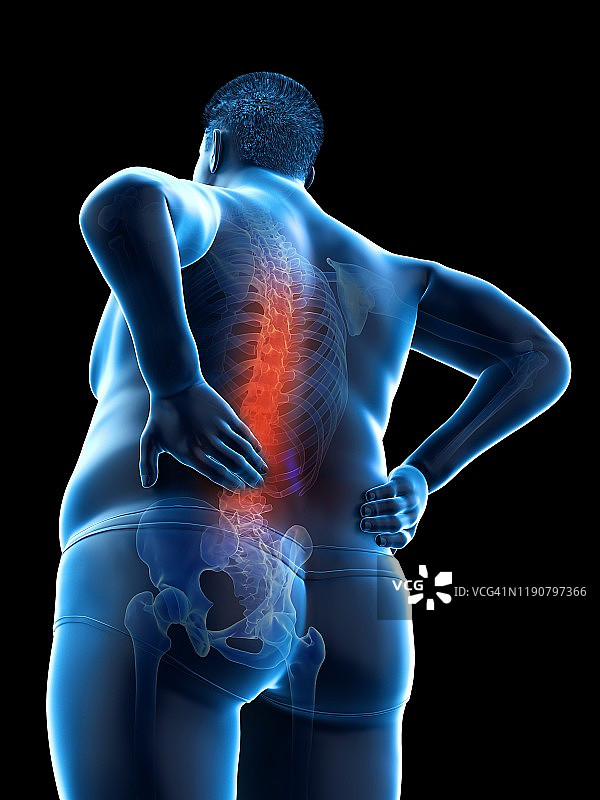 背痛的肥胖男人插画图片素材