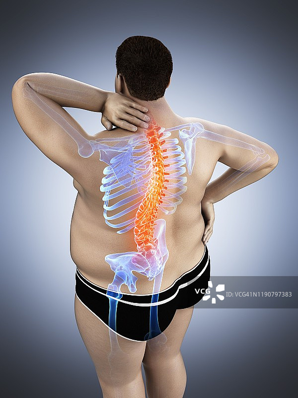 背痛的肥胖男人插画图片素材