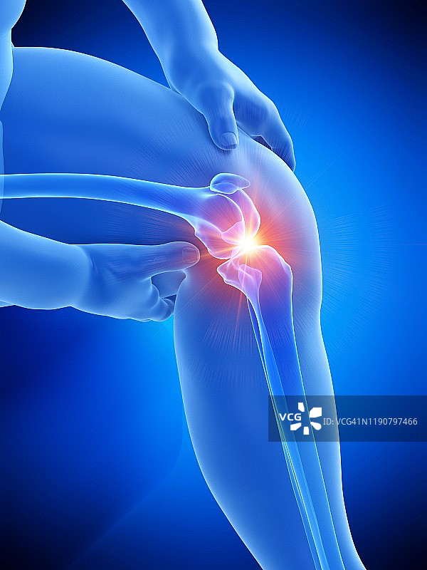 肥胖男人膝盖疼痛插画图片素材