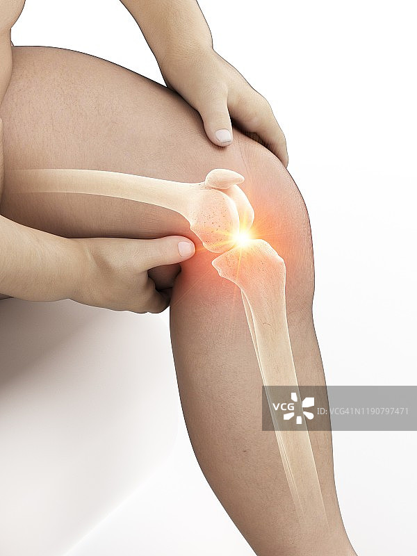 肥胖男人膝盖疼痛插画图片素材