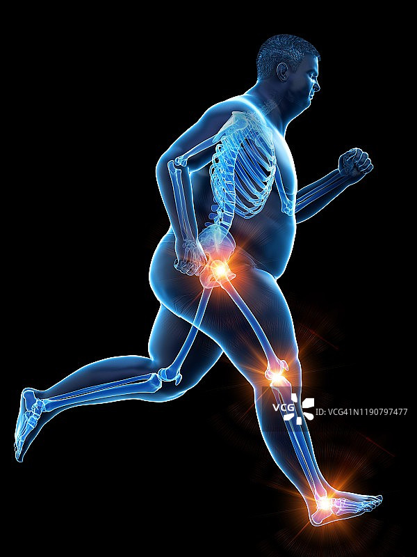 关节疼痛的肥胖跑步者，图示图片素材