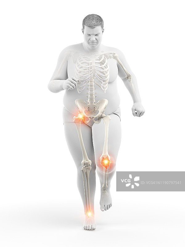 关节疼痛的肥胖跑步者，图示图片素材