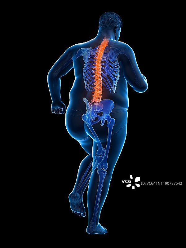 背痛的肥胖跑步者插画图片素材