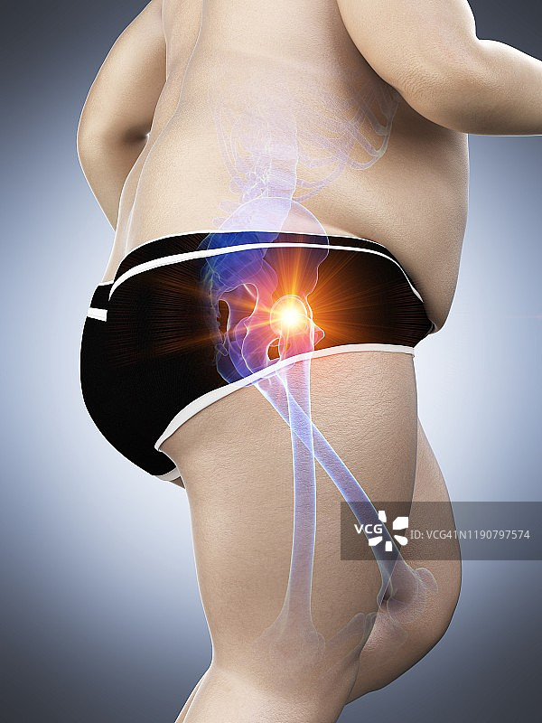 患有髋部疼痛的肥胖跑步者插图图片素材