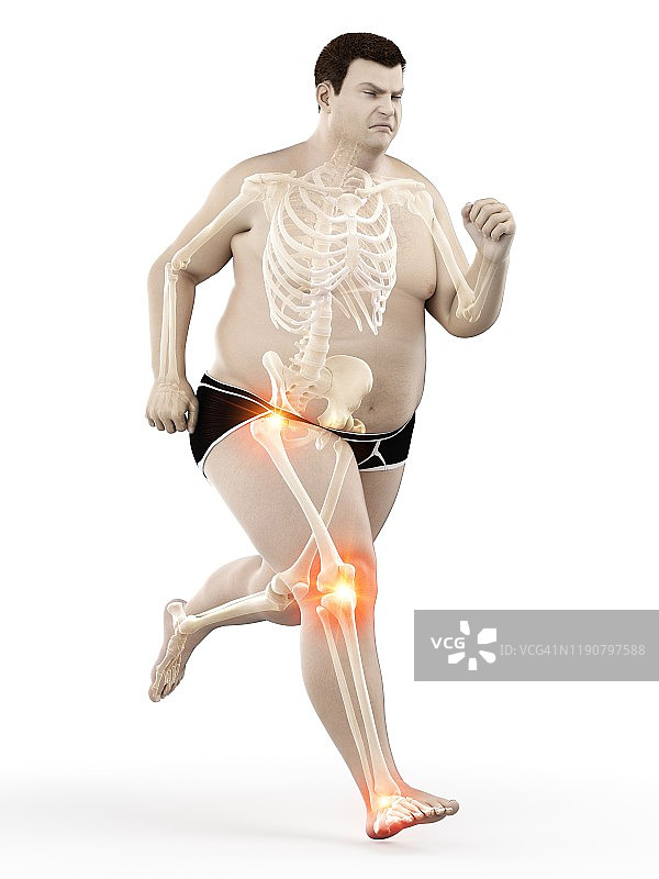 关节疼痛的肥胖跑步者，图示图片素材