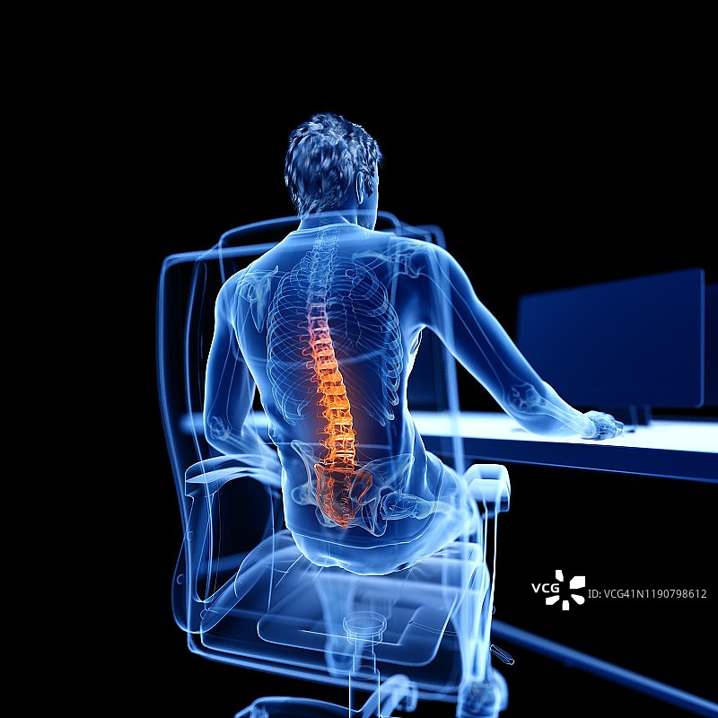 背痛的上班族插画图片素材