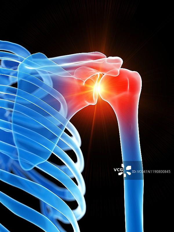 肩痛概念插图图片素材