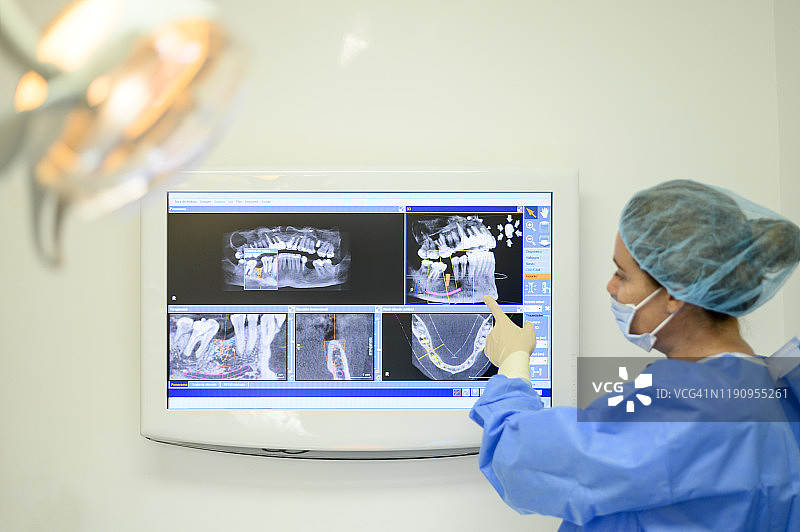 牙科医生展示牙科植入X光片图片素材