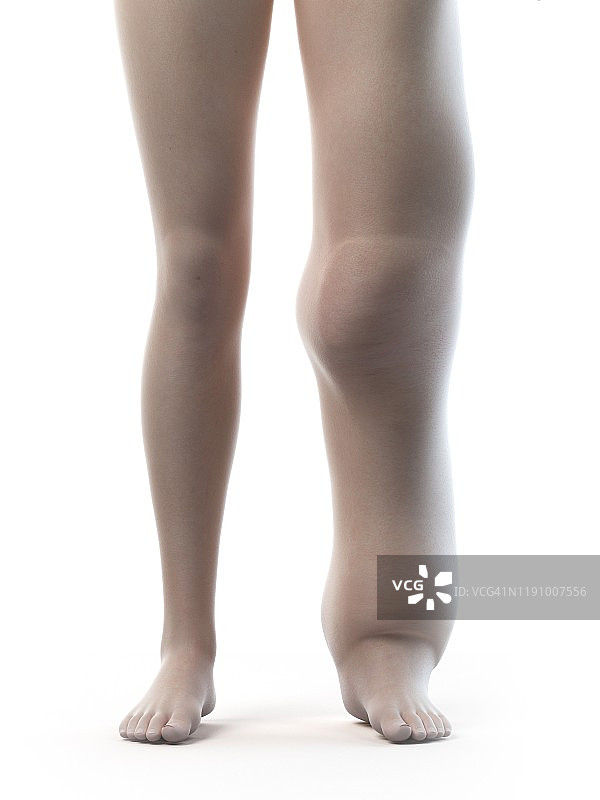 淋巴水肿，图示图片素材