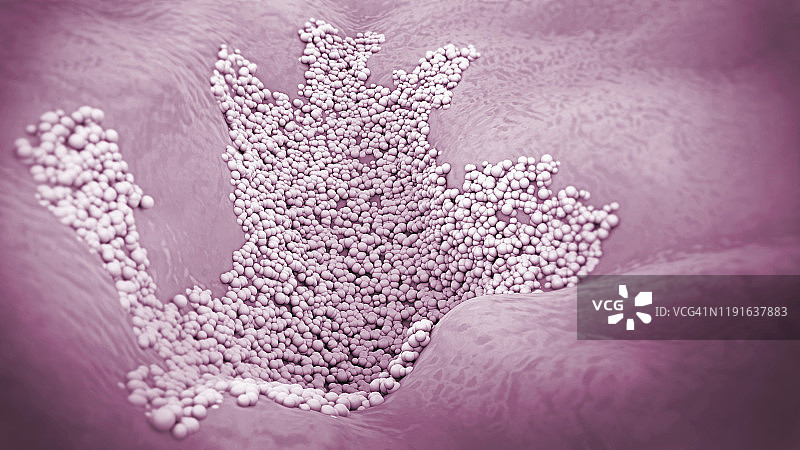 真菌性皮肤感染插图图片素材