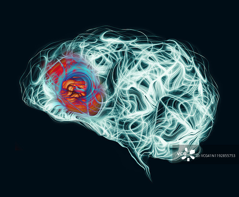 前额头痛图片素材