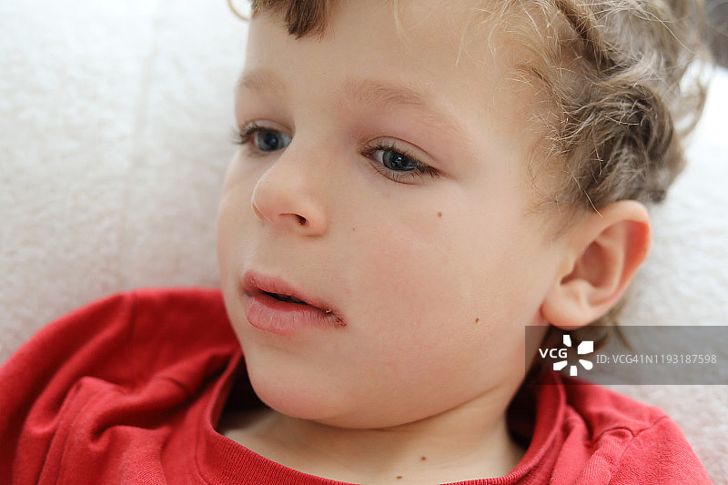 小男孩干裂的嘴唇图片素材