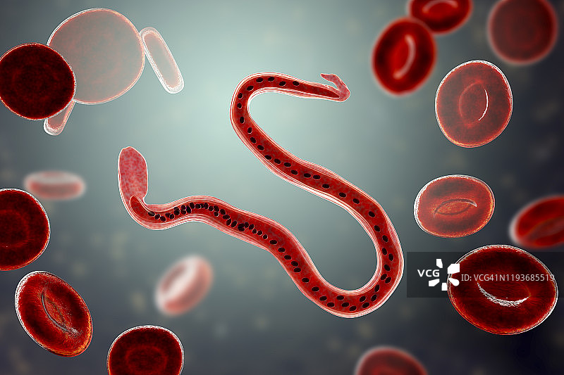 班氏丝虫寄生虫插图图片素材