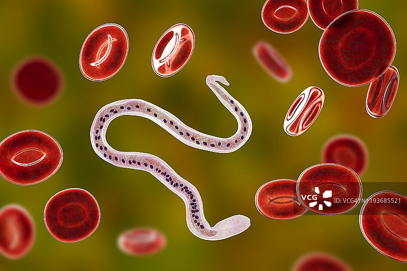班氏丝虫寄生虫插图图片素材