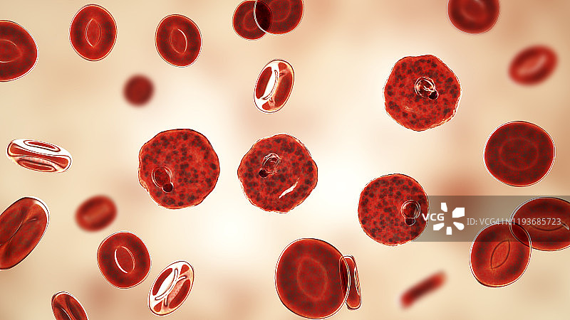 间日疟原虫在红细胞内，图示图片素材