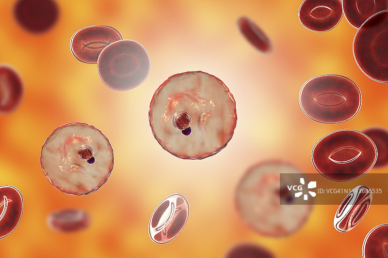 在红细胞内的疟原虫，图示图片素材