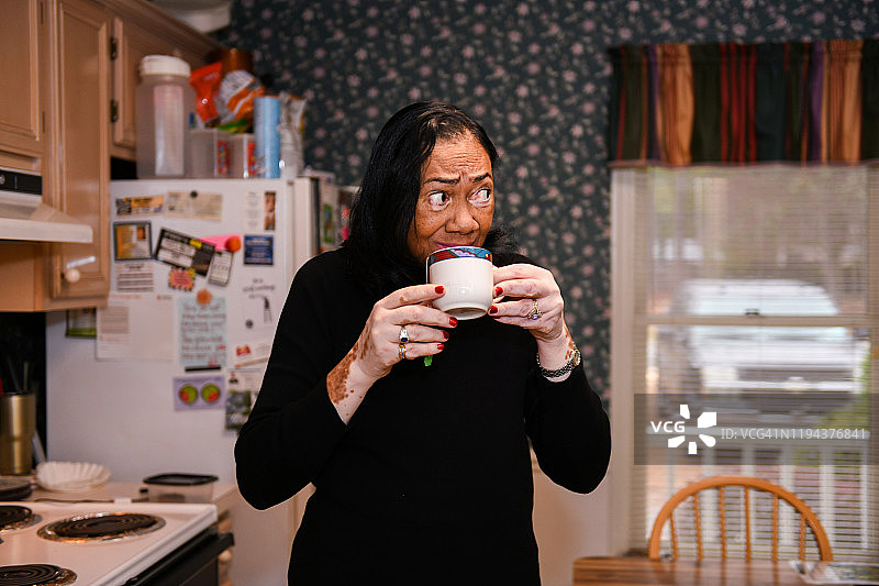 在厨房喝茶的患有白癜风的中年有色人种女性肖像图片素材