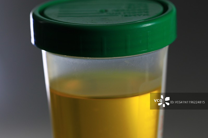 用于测试的医疗尿液样本图片素材